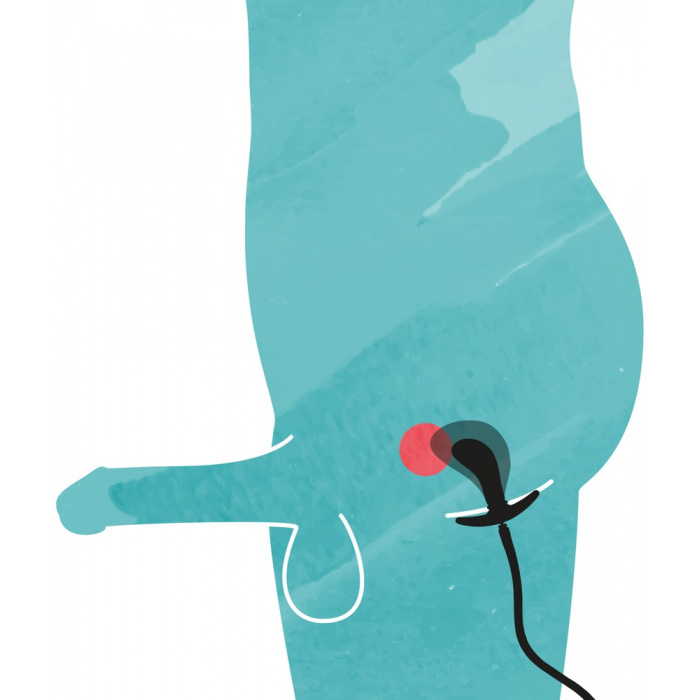 Inflatable Plug - Image 2